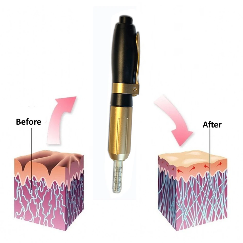 Ручка гиалуроновой кислоты высокого давления, новейший 0,5 мл немой Регулируемый кислотный пистолет для защиты от морщин/подъема губ распылитель гиалурон ручка