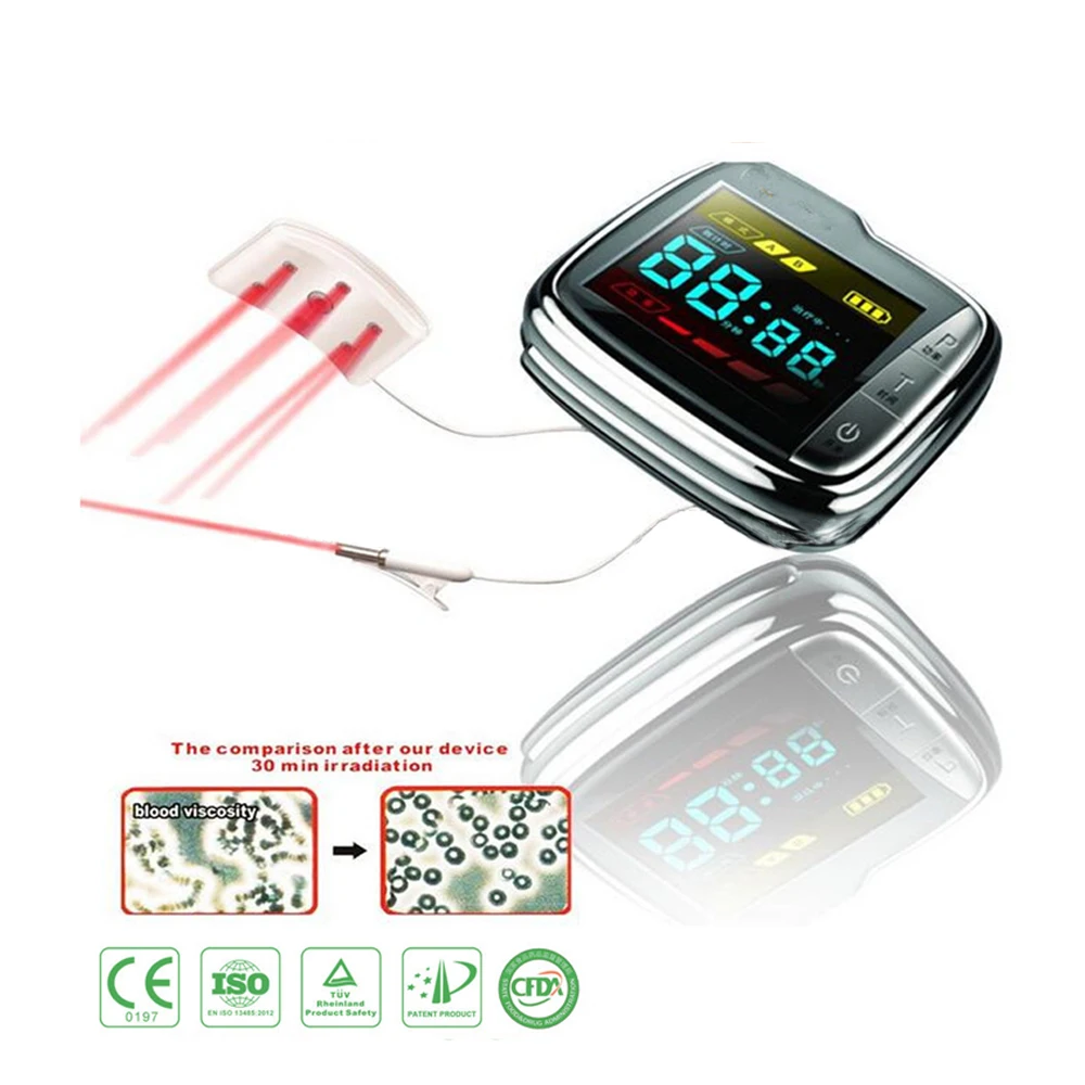 

18 laser diodes Wrist Physical Therapeutic Watch for for treating hyperviscosity, hyperlipidemia and diabetes