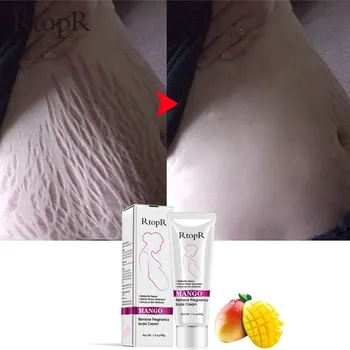 comprar Creme Macio Não Irritante Natural Da Marca De Estiramento Da Manga Para A Linha Da Folga Da Cicatriz Do Reparo Da Gravidez Creme Das Estrias Do Abdômen