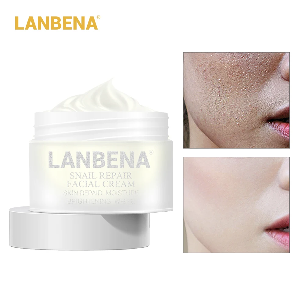 LANBENA Skin Recovery Whitening Cream Snail Facial Anti Wrinkle Anti-Aging Cream Acne Treatment Moisturizing Firming Skin Care LANBENA Skin Recovery Whitening Cream Snail Facial Anti Wrinkle Anti-Aging Cream Acne Treatment Moisturizing Firming Skin Care