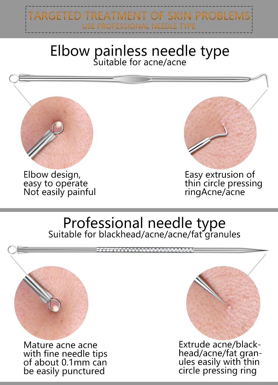 Игла для удаления прыщей черных точек, средство для удаления пятен и жира, инструмент для ухода за кожей, набор экстракторов для лечения акне, 4 шт