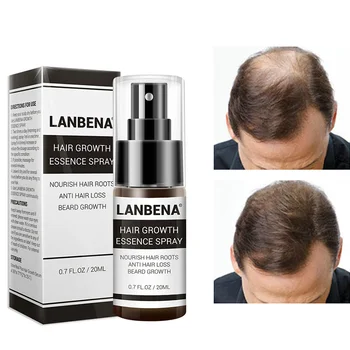 

20ml Men and Women Hair Growth Essence Spray Preventing Baldness Consolidating Anti Hair Loss Nourish Roots Portable Hair Care