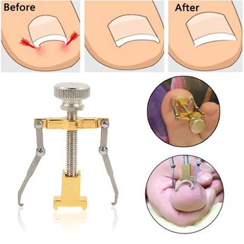 

Useful Ingrown Toenail Manicure Pedicure Clipper Fixer Recover Toenail Correction Tool
