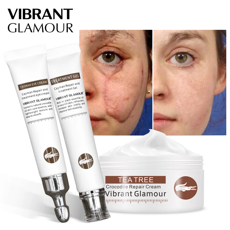 VIBRANT GLAMOUR Repair Scar Cream Set Crocodile Eye Cream Remove Dark Circle Whitening Remove Stretch Marks Skin Care Anti-Aging