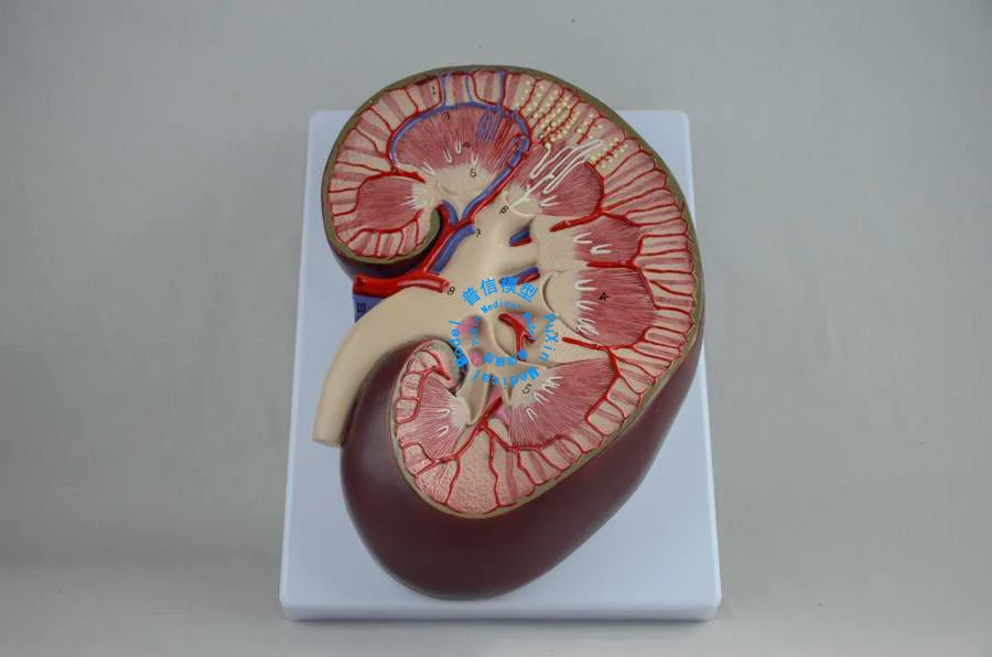 Free shipping&Renal anatomy, renal anatomy model, magnifying kidney