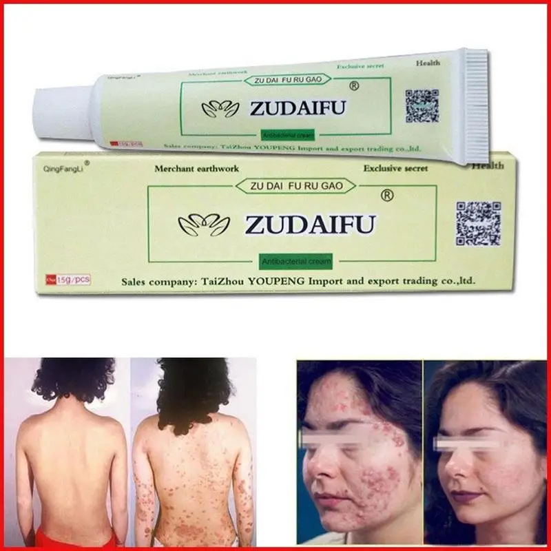 15 г ZUDAIFU крем от псориаза уход за кожей массаж тела Zudaifu крем от псориаза с розничной коробкой товары для здоровья дропшиппинг
