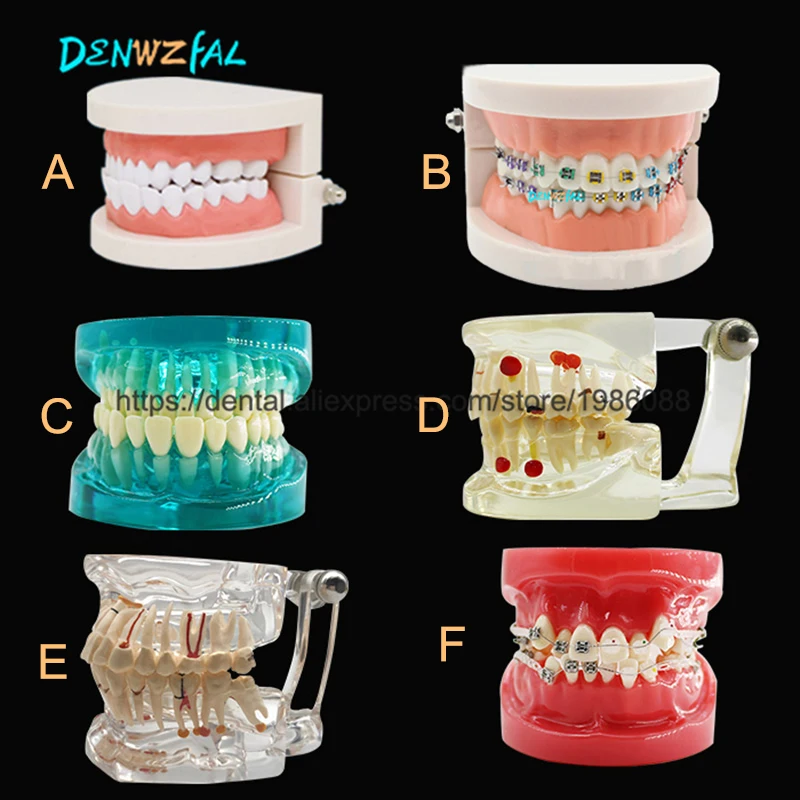 Различные стоматологические модели зубов используются для обучения и больницы стоматолога материала