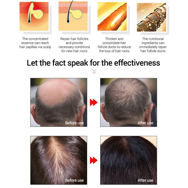 Средства с эссенцией для рост волос Эфирное Масло жидкое лечение Предотвращение выпадения волос уход за волосами Andrea 20 мл