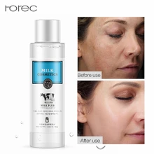 Молочко осветляет увлажняющий тоник уход за кожей эссенция против морщин нестареющее лечение от прыщей, отбеливание удаление пятен черных точек 120 мл