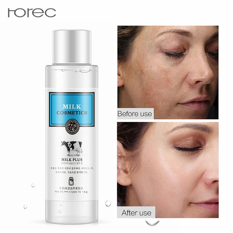 

Milk Brighten Toner Moisturizing Skin Care Essence Anti Wrinkle Ageless Acne Treatment Whitening Blemish Remove Blackhead 120ml
