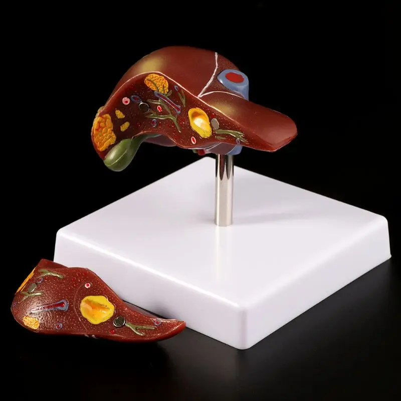 Человеческая печень патологическая анатомическая модель Анатомия школа медицинское обучение дисплей инструмент лабораторное оборудование