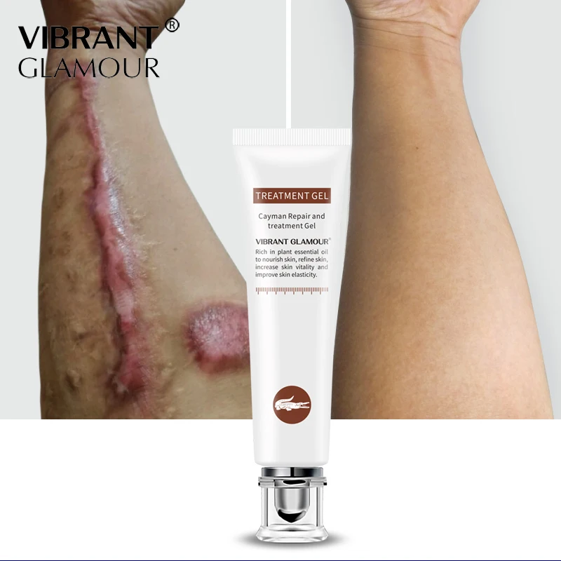

VIBRANT GLAMOUR Repair Scar cream Removal Acne Scars Stretch Marks CreamSurgical scar Burn For Body Pigmentation Corrector care