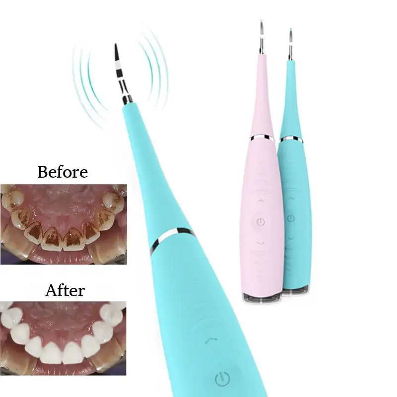 

VIBRANT GLAMOUR Portable Electric Sonic Dental Tooth Calculus Remover Tooth Stains Tartar Tool Dentist Whiten Teeth Health Tool