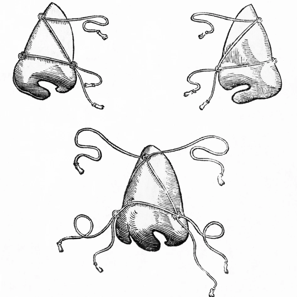 Tagliacozzi's Post-Operative Nose Masks  1500s Poster Print by Science Source (18 x 24)