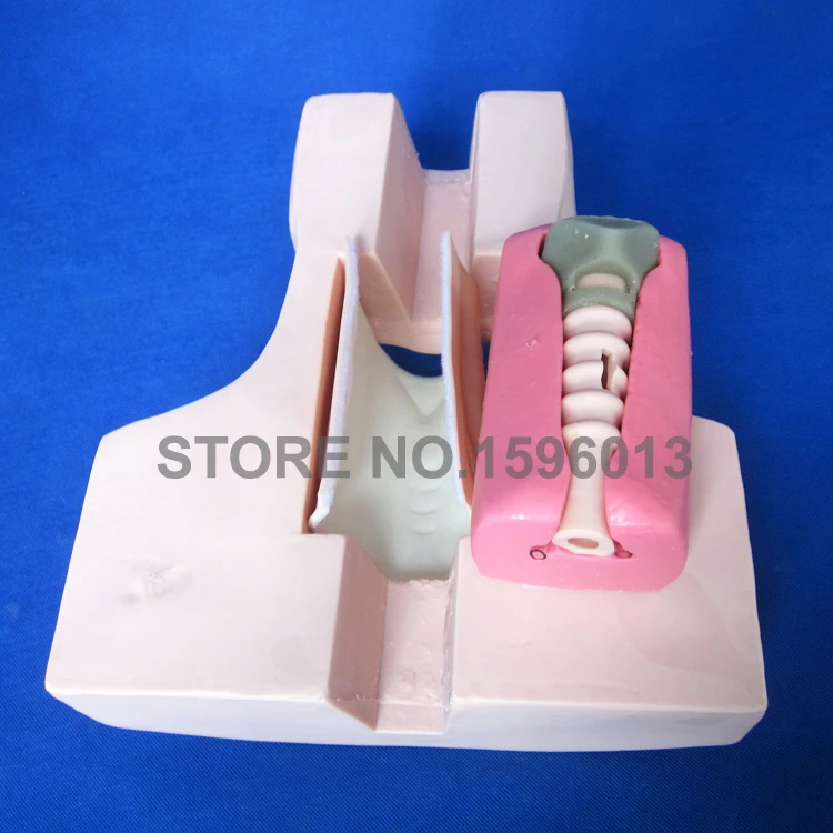 58 Tracheostomy (4)