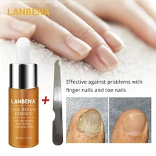 LANBENA средство для восстановления ногтей сыворотка грибковое средство для осветления ногтей Удаление онихомикоза ноготь питательный уход за руками и ногами