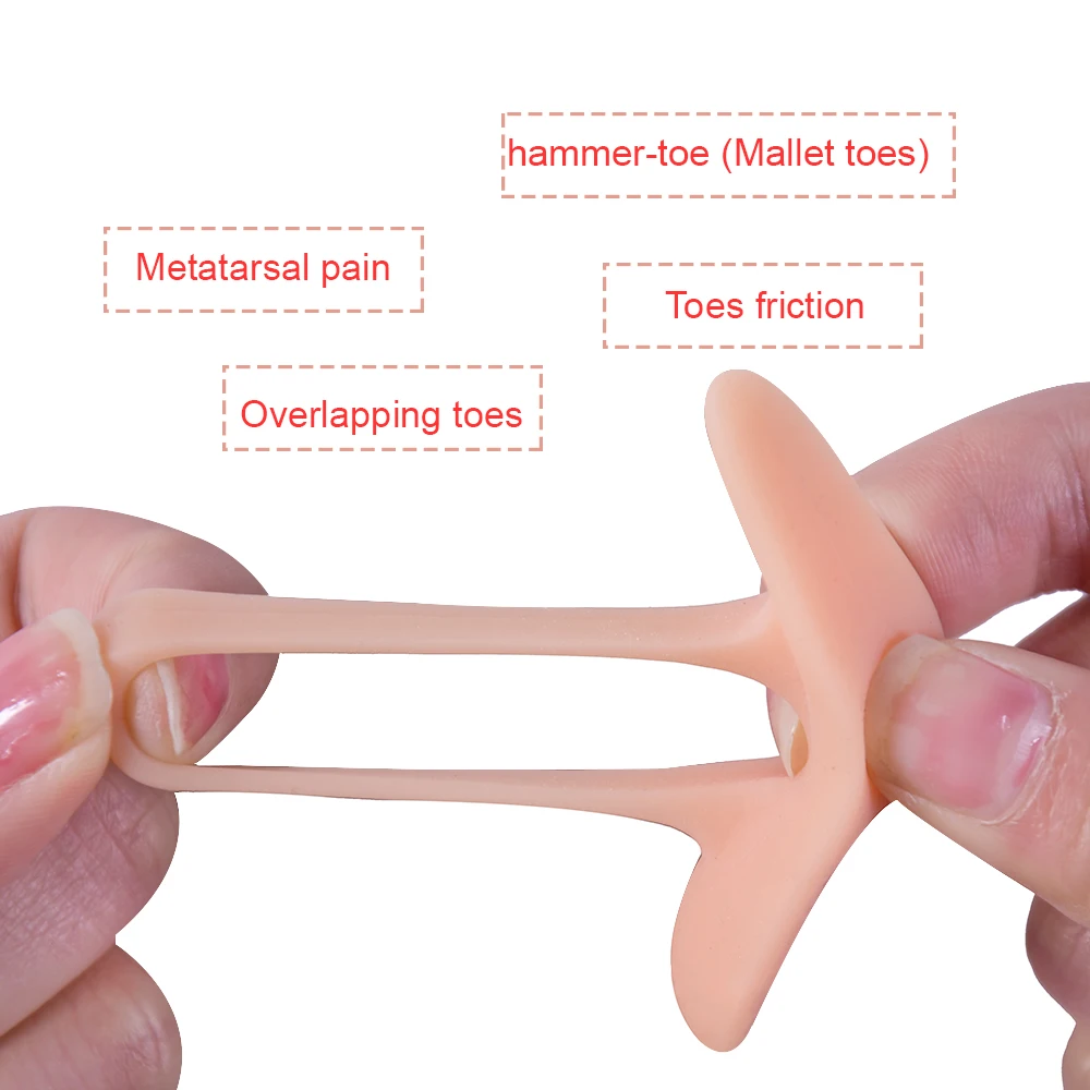 1 пара отделение молотка на пальце пальца в вальгусной деформации Ортодонтическое приспособление при изгибе
