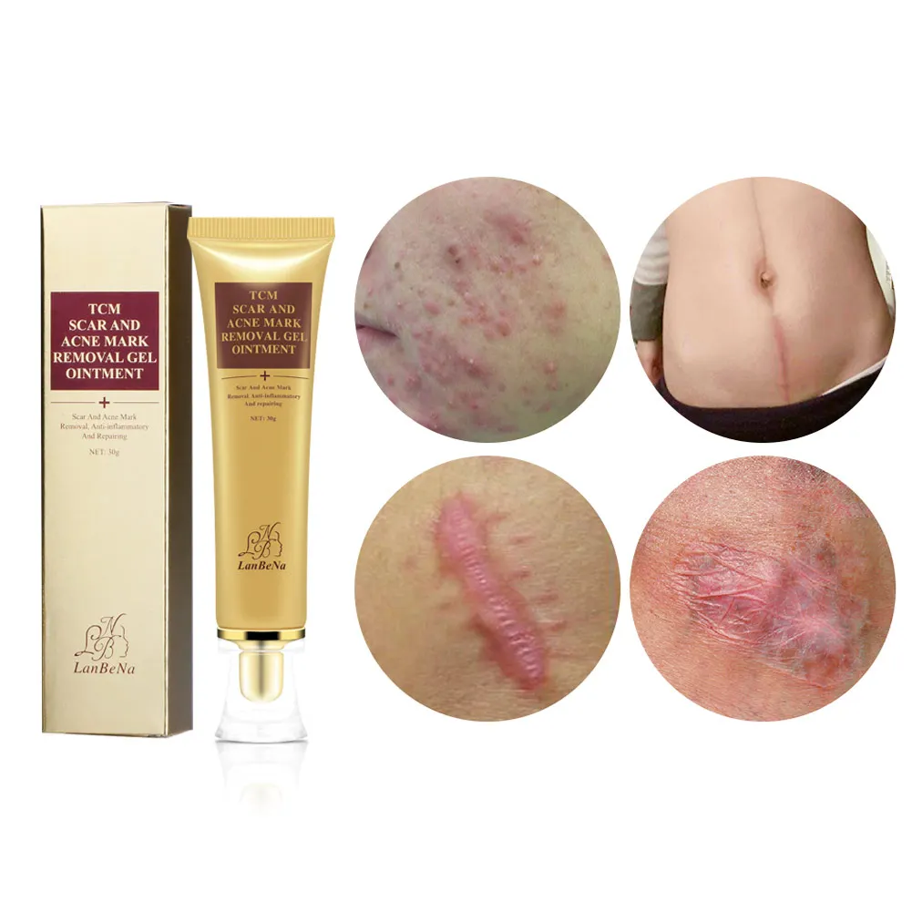 

LANBENA Scar Repair Cream Ginseng Extract Scar Removal Gel Remove Pregnancy Scars Acne Cream Anti-Aging Body Creams J75