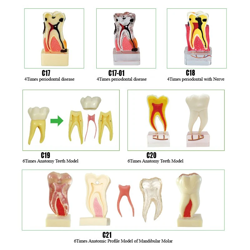 4 раза Стоматологическая модель зубов для пародонтала 6 раз анатомическая модель зубов для стоматологического обучения манекен