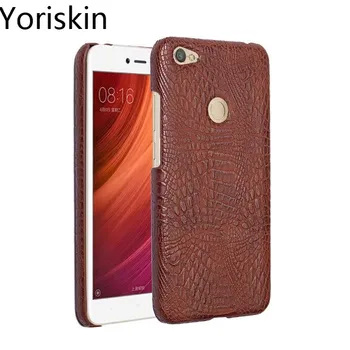 

Case For Redmi Note 5A Luxury Crocodile Skin Drop Proof Protective Hard Slim Back Cover For Xiaomi Redmi Note 5A Phone Case