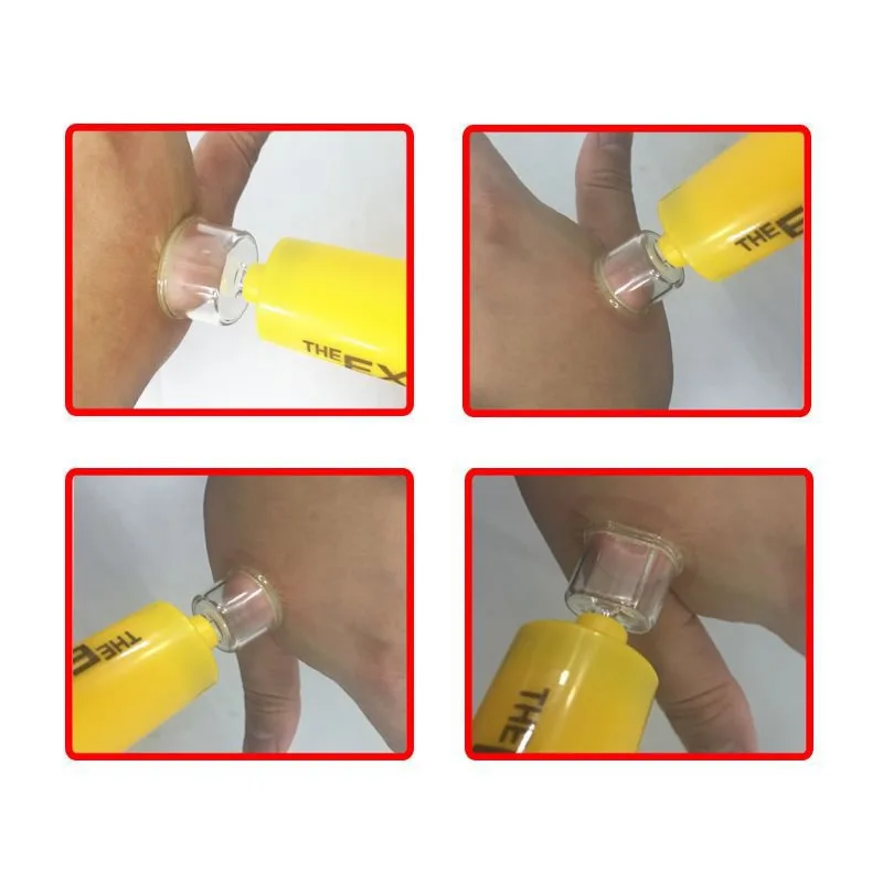 Portátil al aire libre Venom Extractor serpiente insectos Bite herida de emergencia Kit de tratamiento para el campamento al aire libre Primeros Auxilios Kit Dropshipping