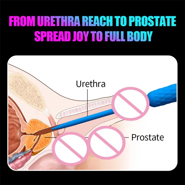 Urethral Vibrator (6)