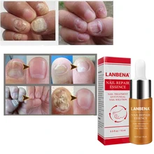LANBENA руки и уход за ногами и ногтями ремонт грибка эссенция сыворотки грибка toenail грибка удалить онихомикоз Уход за ногтями восстанавливающая жидкость