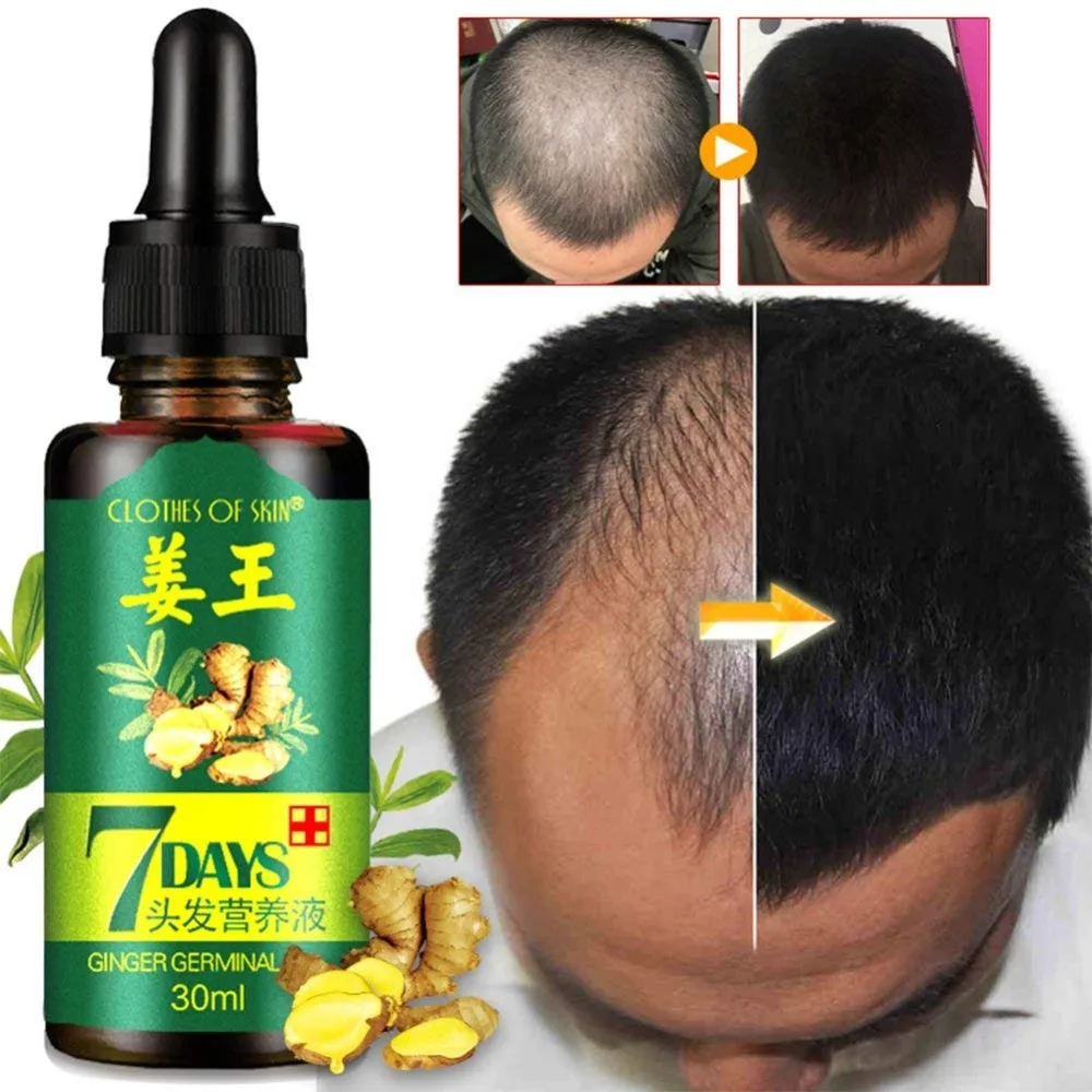 7 дней имбирь Germinal сывороточная эссенция масло естественное выпадение волос лечение эффективный быстрый рост Уход за волосами 30 мл