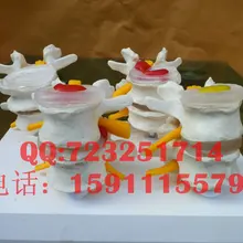 Талии поясничного модели болезнь поясничного диска Патологии Модель скелет модели