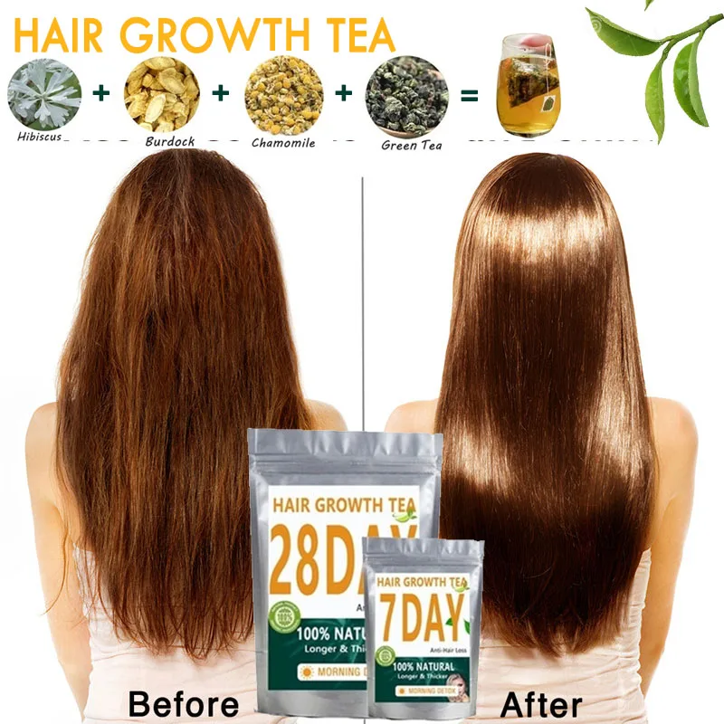 7 Days Natural Hair Regrowth Tea Anti-hair Loss Products Scalp Treatment Tea  Hair Growth Tea Damaged Hair Repair Growing Faster - Hair Loss Product  Series - AliExpress