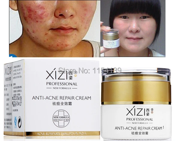 no acne cream
