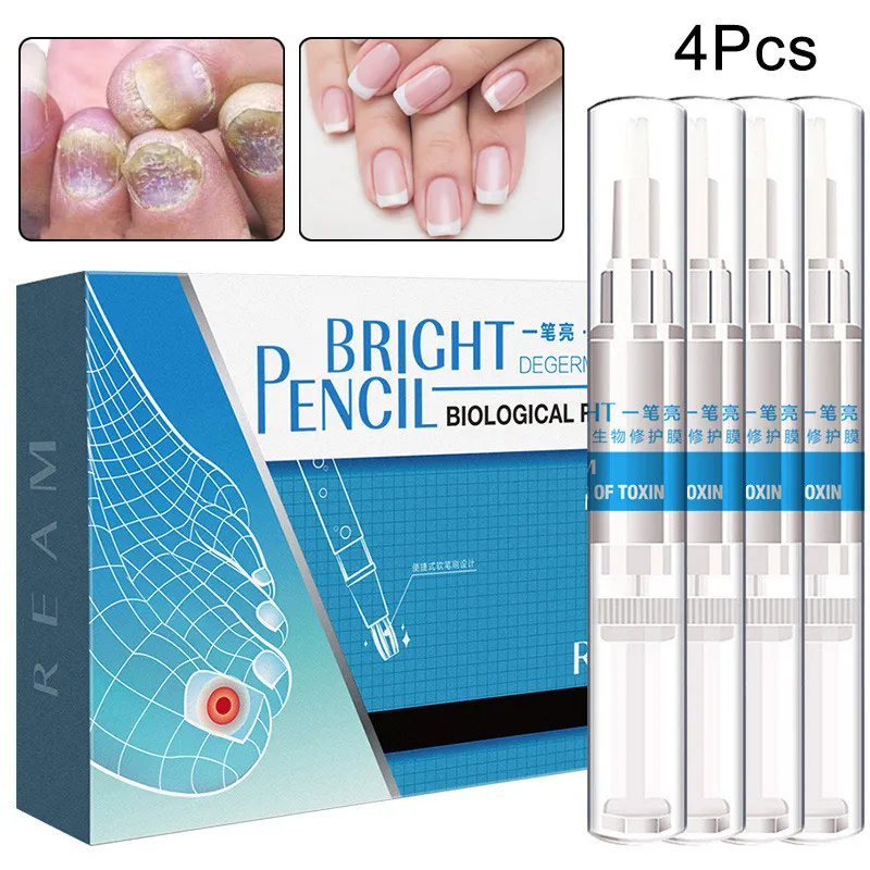 4 Pcs/box 3ml Nail Fungal Treatment Anti Fungus Toenail Fingernail Nails Repair Care Liquid Onychomycosis Treatment Liquid