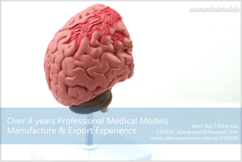 BRAIN10 CMAM model brain diseases anatomical model 5