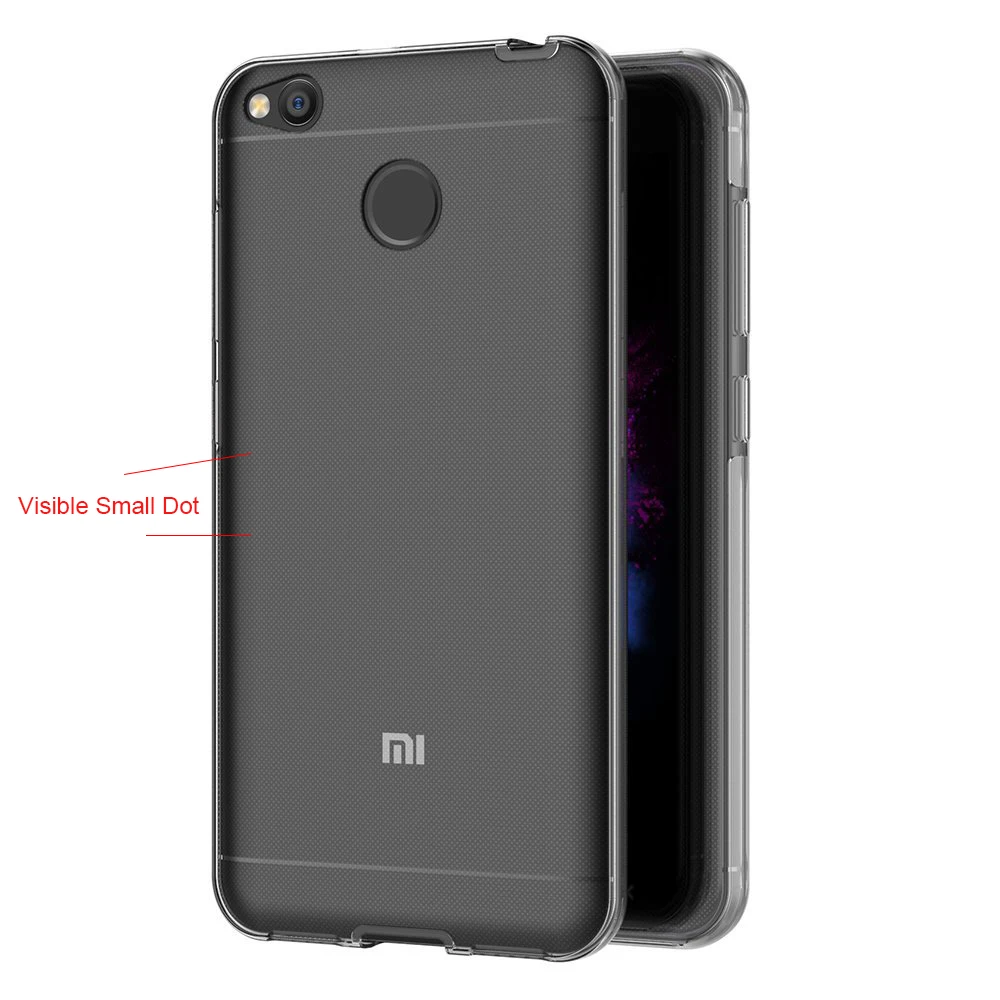 Прозрачный силиконовый чехол с поворотом на 360 градусов для Xiaomi Mi A1 Redmi 5 Plus 4X 5A