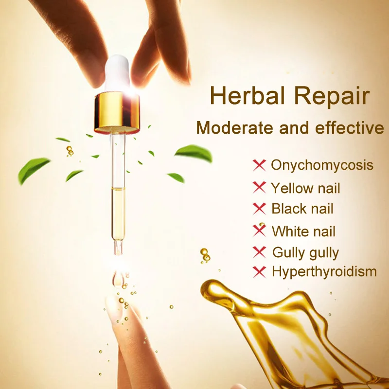 30ml Effective Nail Fungal Treatment Liquid for Toenail Fingernail Anti Fungus Infection Nail Care Herb Essence Fluid