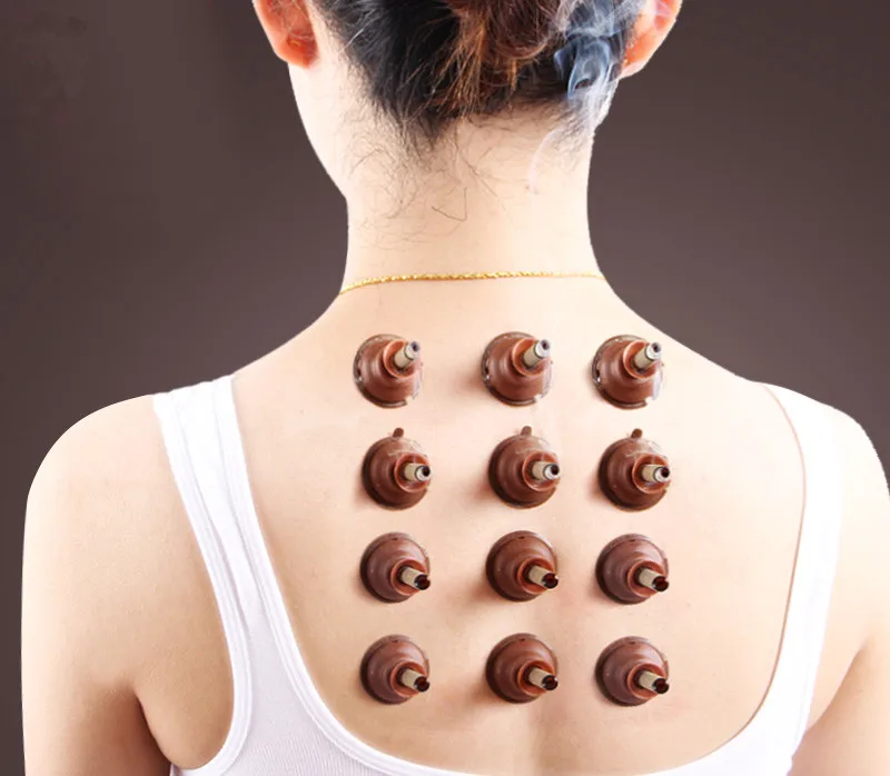 Acupuncture and moxibustion of traditional Chinese medicine meridian