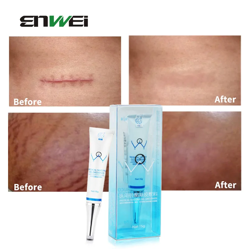 Scar Removal Cream Safe Effective Medical Silicone Acne Scars Gel Flatten Repair Burn C-Section Keloid Scars Treatment Face Body
