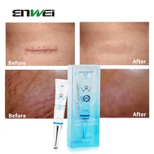 Scar Removal Cream Safe Effective Medical Silicone Acne Scars Gel Flatten Repair Burn C-Section Keloid Scars Treatment Face Body