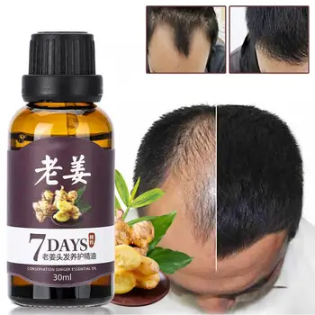 

Hair Loss 30ml Unisex Fast Hair Growth Essence Anti Hair Loss Treatment Nourishing Natural Plant Extract Hair Care