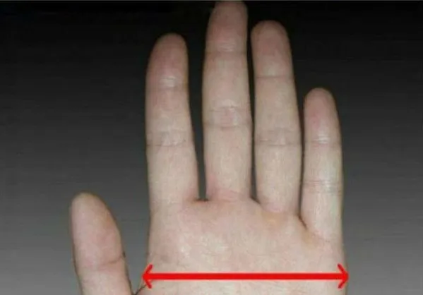 size 