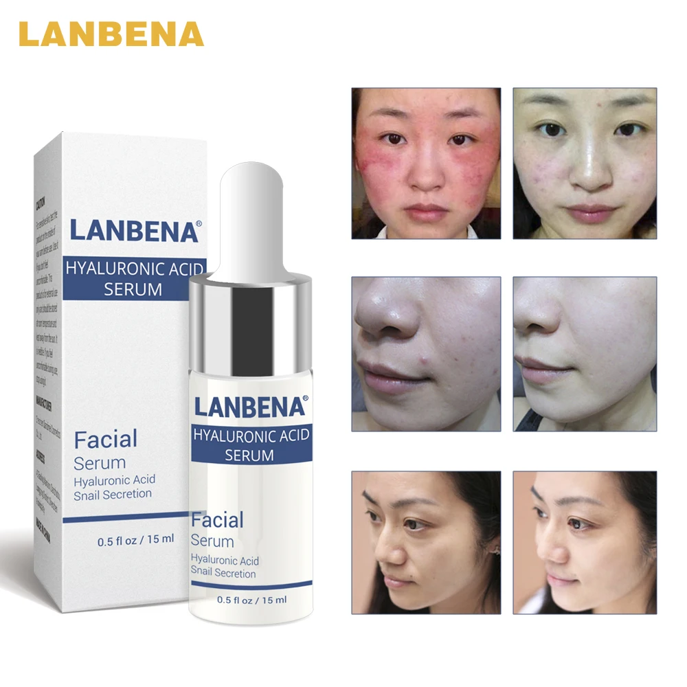 LANBENA Hyaluronic Acid Serum Moisturizing Essence Treat Blackhead Acne