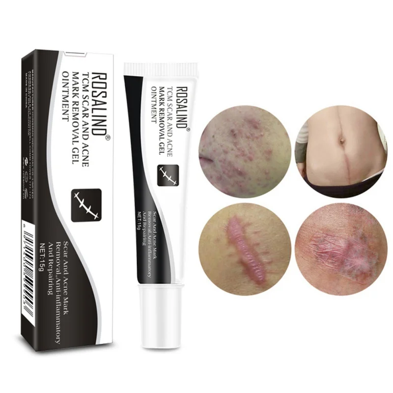 Body Skin Cream Stretch Marks Remove Acne Scar Treatment Cream Face Whitening Cream Body Skin Cream Stretch Marks Remove Acne Scar Treatment Cream Face Whitening Cream