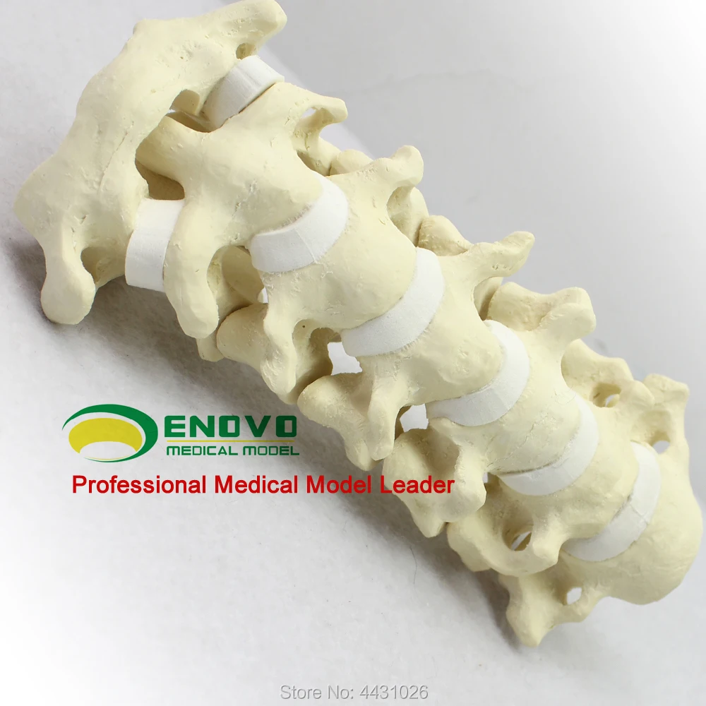 ENOVO Human Cervical Spine Model Anatomy Model Spine Statues Medical Science Teaching