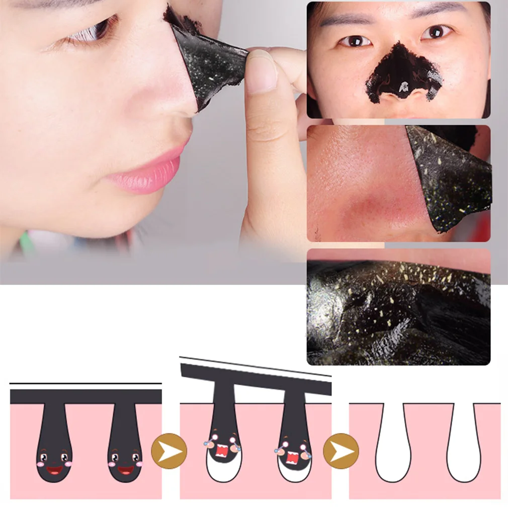 5pc Blackhead Face Mask Remover Nose Mask Deep Cleansing Acne Treatment