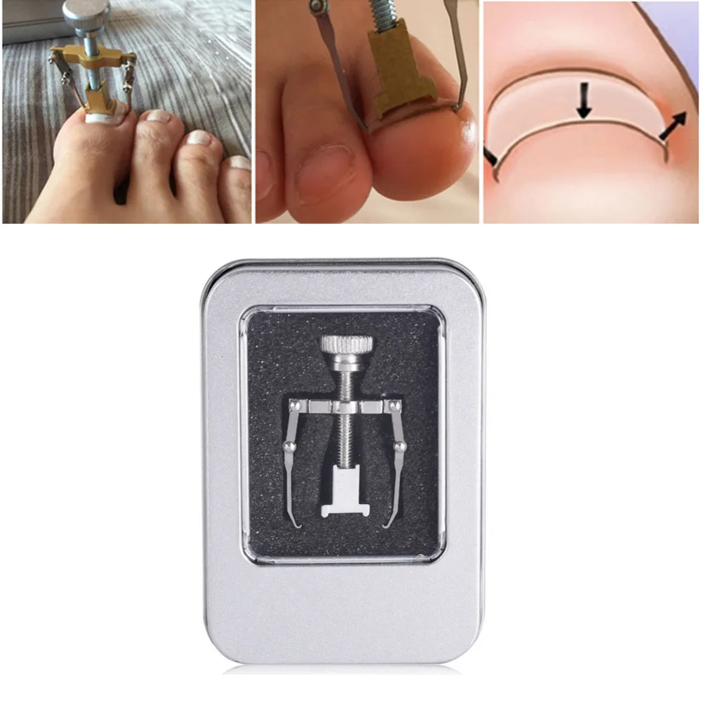 Инструмент для лечения вросшего ногтя из нержавеющей стали инструменты коррекции ногтей для лечения вросшего ногтя