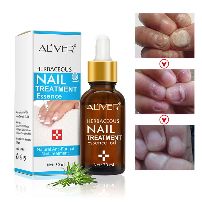 1pc 30ml Anti Infection Fungal Liquid Bright Nail Repair Treatment