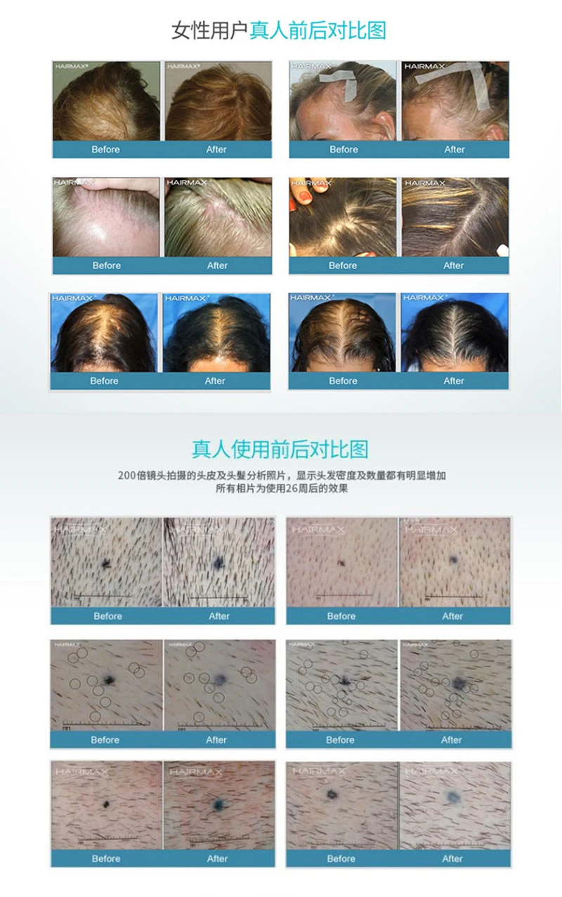 110-220V Лазерная Терапия роста волос шлем-приспособление лазерное лечение облысения поощрения лазерное восстановление роста волос Кепки массажное оборудование