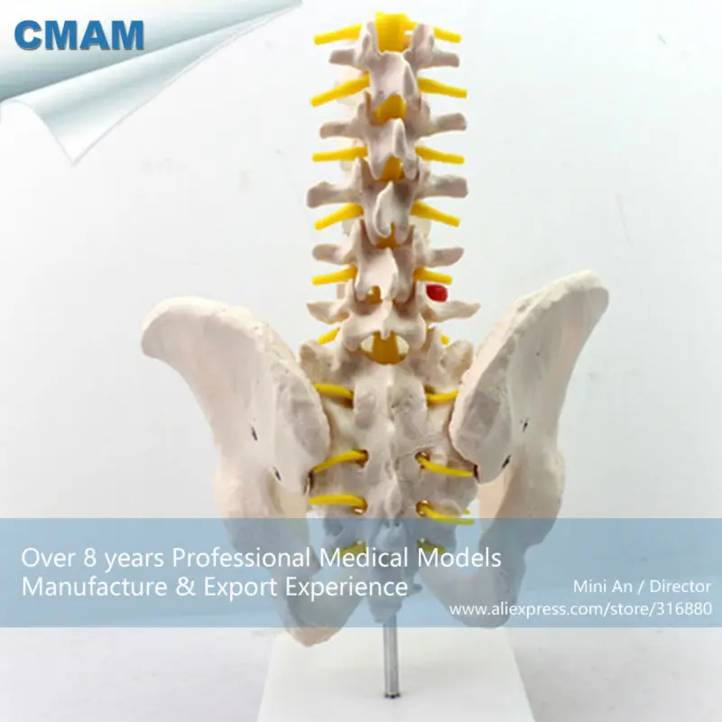 CMAM/12342 таза, L1-L5 поясничного позвонка, Пластик таза медицинский анатомический модель человека