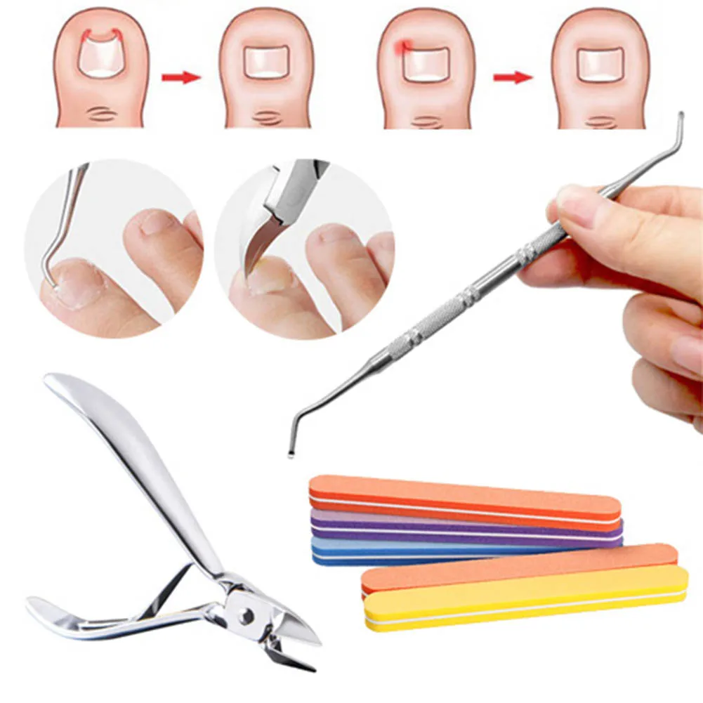 Cuticle Scissors Nail Correction Nippers Clipper Cutter Dead Skin Dirt
