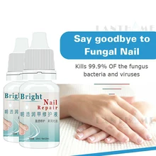10 мл Крем для лечения грибка ногтей Onychomycosis Paronychia против грибковой инфекции ногтей убивает 99.9% бактерий и грибка